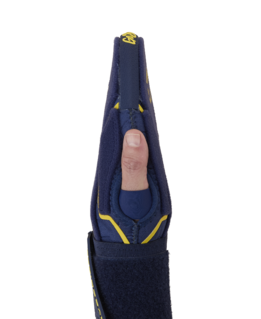 Evoshield X-SRZ Savannah Bananas Adult Sliding Mitt 2.0 WB5767101AD